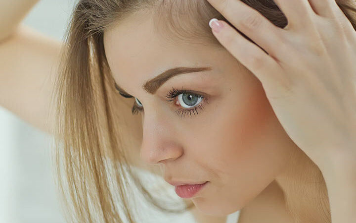 Unlocking Solutions: 8 Simple Ways to Treat Hair Loss at the Temples