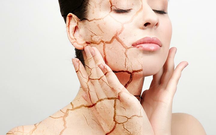 Nourishing Elegance: A Comprehensive Guide on How to Use Multani Mitti for Dry Skin