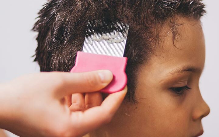 Understanding and Addressing Hair Loss in Children: Causes, Concerns, and Solutions