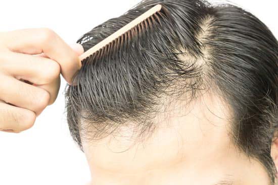 A Comprehensive Guide: How to Prevent Hair Loss Naturally